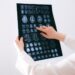 nörolojik rehabilitasyon — Fotoğraf: Anna Shvets (Pexels)
