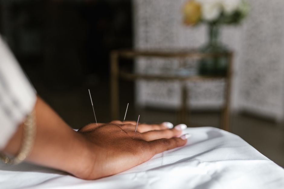 Darıca akupunktur — Fotoğraf: RDNE Stock project (Pexels)